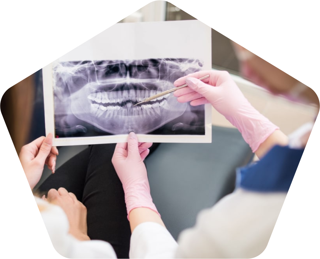 Dental X-Ray for a Dental Emergency