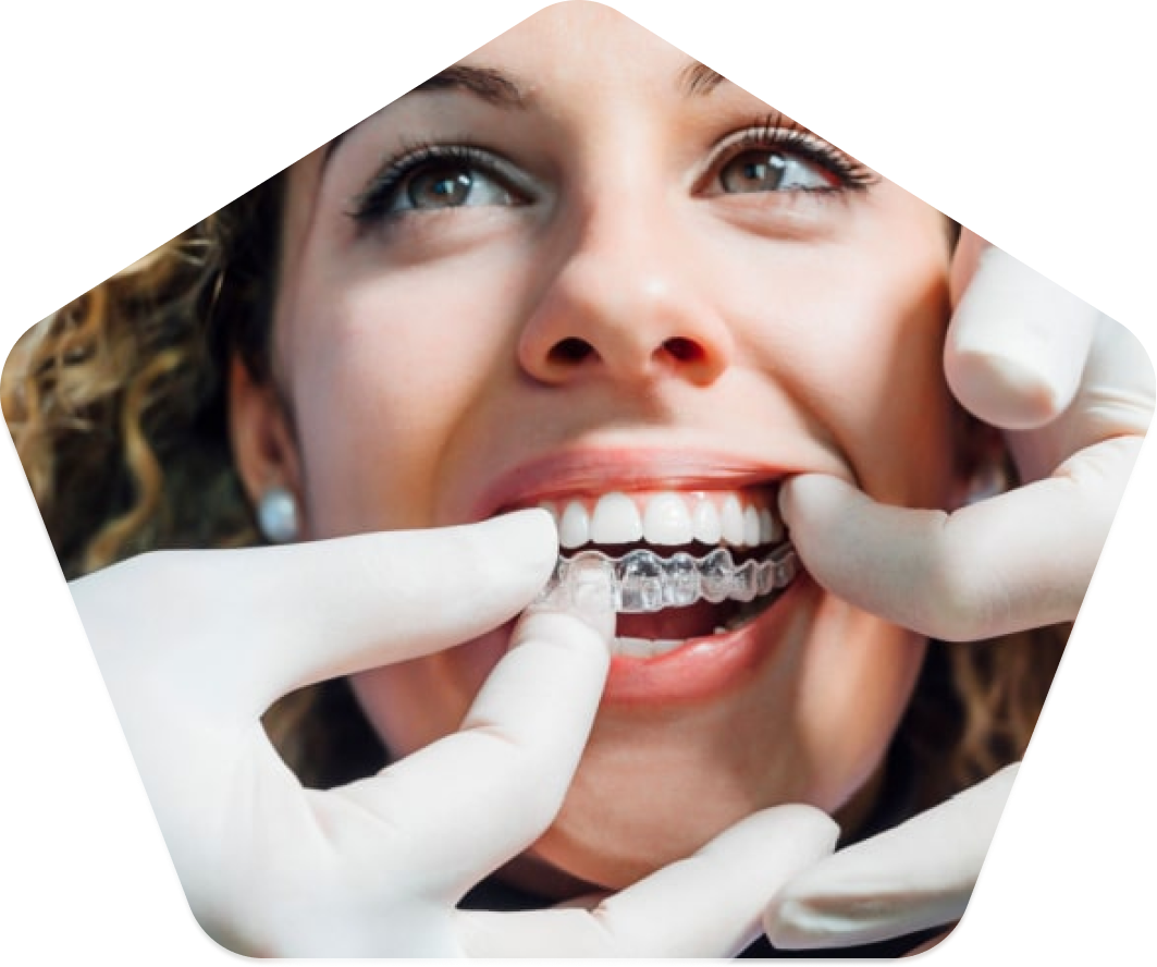 Dentist inserting Invisalign aligners