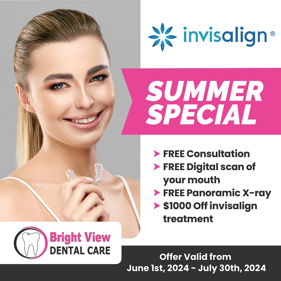 Summer special: $1000 of Invisalign, Free consultation, digital scan, x-ray